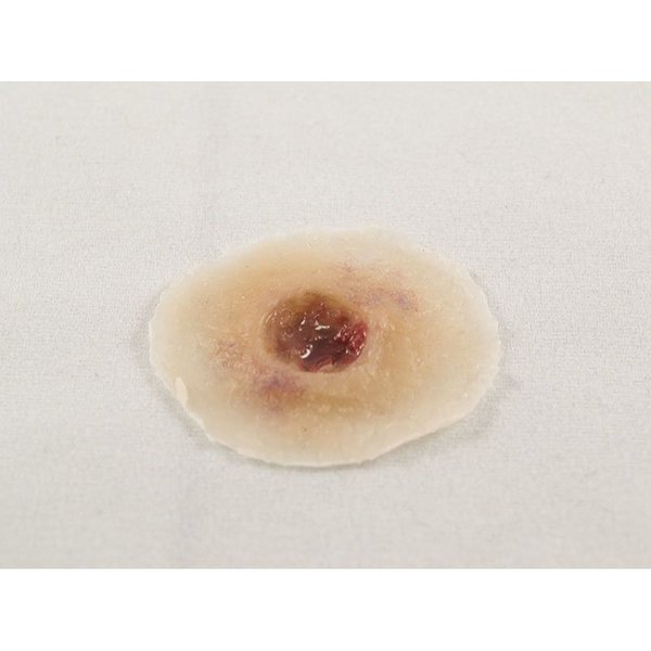 Moulage Science & Training Gunshot Entry Wound, Light, PK 18 MST-01-02-18